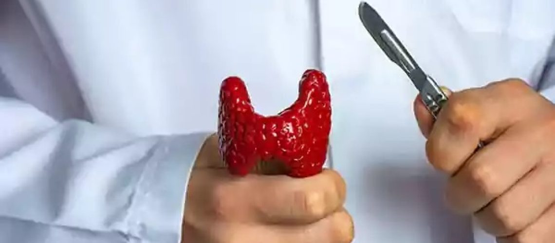 برداشتن غده تیروئید