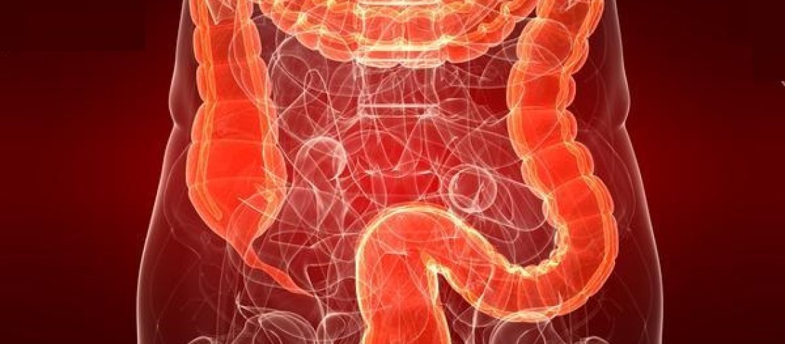 چسبندگی روده